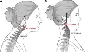 figure-2-chin-tuck