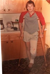 Matt Scotton at age 14 after ACL surgery